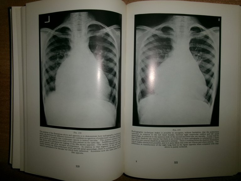 AA. VV. A Second Portfolio of Chest Radiographs for Undergraduate..LE …