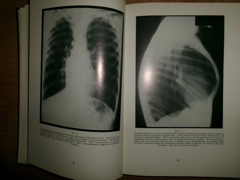 AA. VV. A Second Portfolio of Chest Radiographs for Undergraduate..LE …