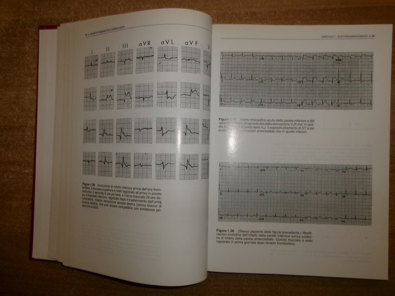 AA. VV. ATLANTE DIAGNOSTICO CARDIOLOGICO. Ed. It. ALESSANDRO DISTANTE 1996