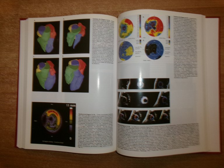 AA. VV. ATLANTE DIAGNOSTICO CARDIOLOGICO. Ed. It. ALESSANDRO DISTANTE 1996