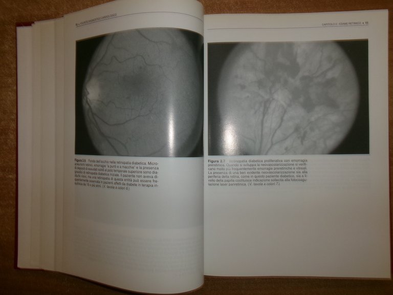 AA. VV. ATLANTE DIAGNOSTICO CARDIOLOGICO. Ed. It. ALESSANDRO DISTANTE 1996
