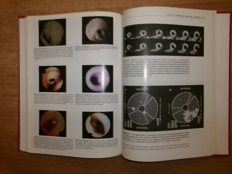 AA. VV. ATLANTE DIAGNOSTICO CARDIOLOGICO. Ed. It. ALESSANDRO DISTANTE 1996