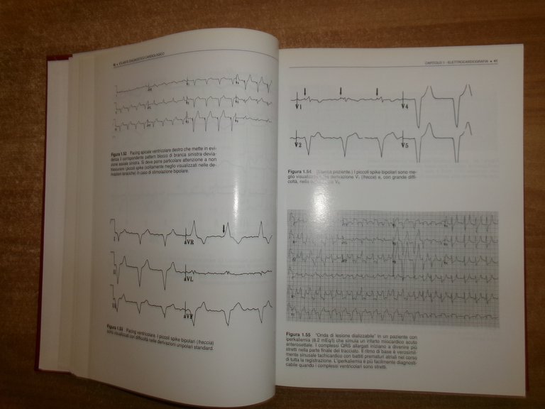 AA. VV. ATLANTE DIAGNOSTICO CARDIOLOGICO. Ed. It. ALESSANDRO DISTANTE 1996