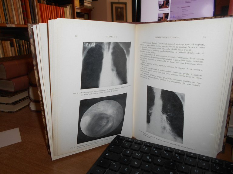 AA. VV. DOMENICO CAMPANACCI. Giornale di Clinica Medica anno LIV …