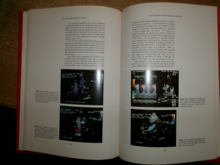 AA. VV. ECOCARDIOGRAFIA DOPPLER A COLORI. DIAGNOSTICA DELLE CARDIOPATIE...