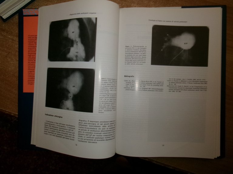 AA. VV. ECOCARDIOGRAFIA DOPPLER A COLORI. DIAGNOSTICA DELLE CARDIOPATIE...