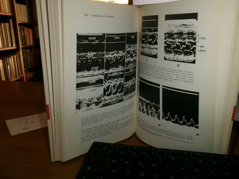 AA. VV. From cardiac catheterization data to hemodynamic parameters 1972