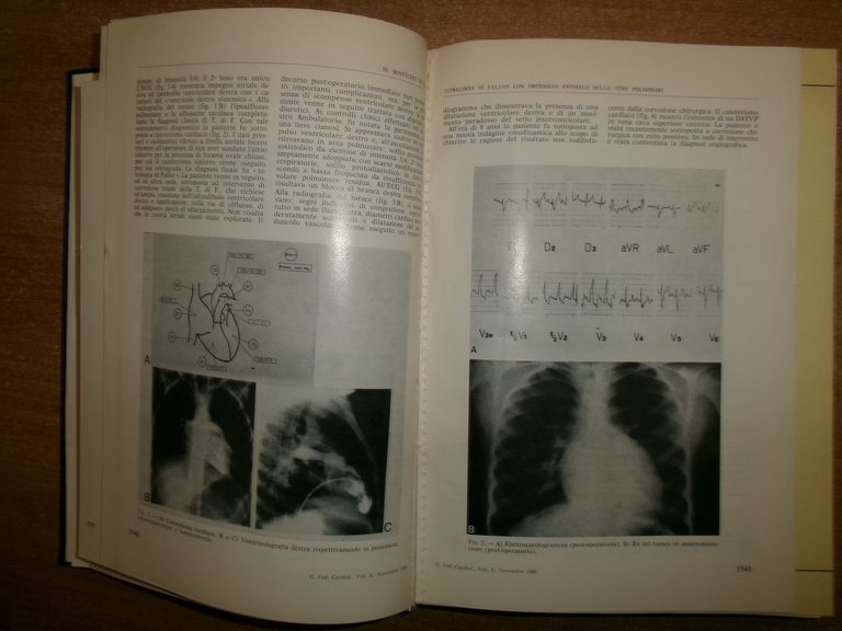 AA. VV. Istituto di Cardiologia Pubblicazioni Scientifiche 1980 - 1981