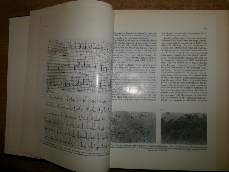 AA. VV. Istituto di Cardiologia Pubblicazioni Scientifiche 1990-1992