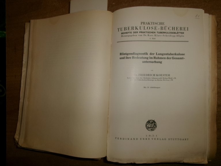 AA.VV. MISCELLANEA di numerosi opuscoli riguardanti la TUBERCOLOSI 1930