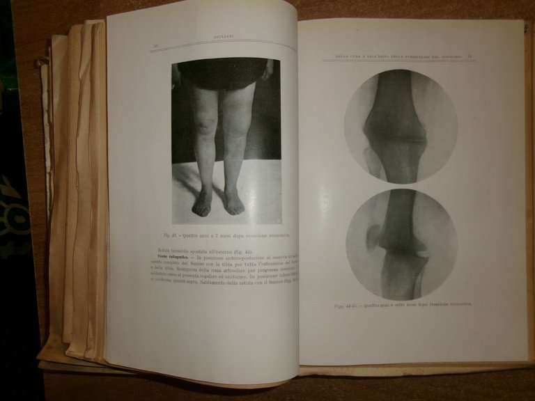 AA.VV. MISCELLANEA di numerosi opuscoli riguardanti la TUBERCOLOSI 1930