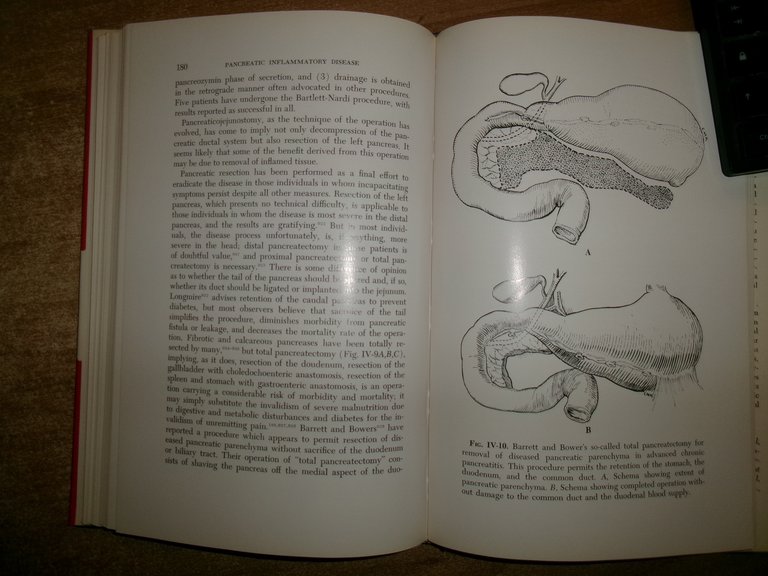 AA. VV. Pancreatic Inflammatory Disease: A Physiologic Approach 1964