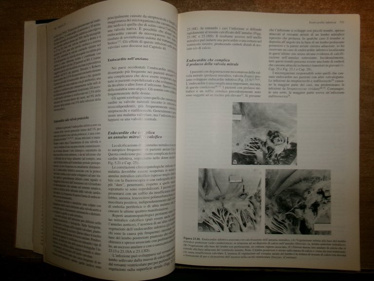 AA. VV. PATOLOGIA CARDIOVASCOLARE. MALCOM D. SILVER edizione italiana 1994