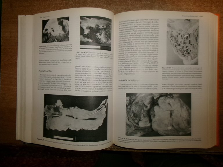 AA. VV. PATOLOGIA CARDIOVASCOLARE. MALCOM D. SILVER edizione italiana 1994