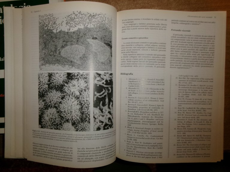 AA. VV. PATOLOGIA CARDIOVASCOLARE. MALCOM D. SILVER edizione italiana 1994