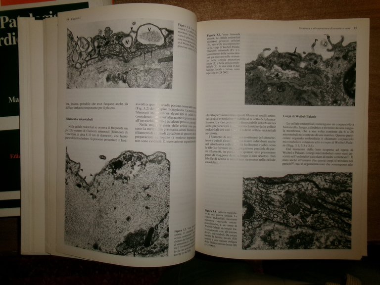 AA. VV. PATOLOGIA CARDIOVASCOLARE. MALCOM D. SILVER edizione italiana 1994