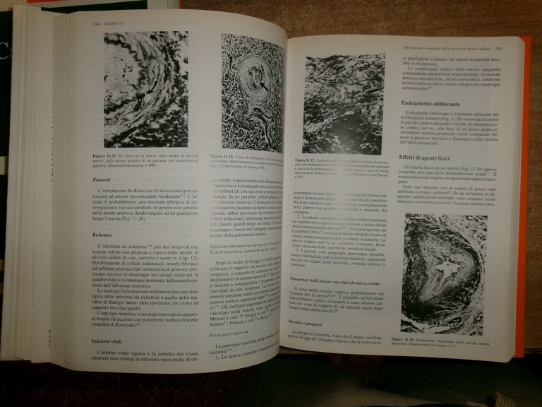 AA. VV. PATOLOGIA CARDIOVASCOLARE. MALCOM D. SILVER edizione italiana 1994