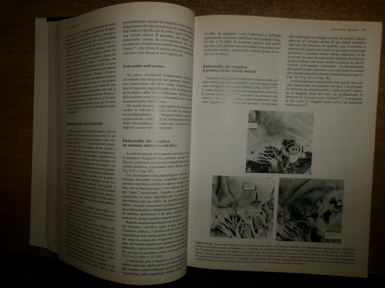 AA. VV. PATOLOGIA CARDIOVASCOLARE. MALCOM D. SILVER edizione italiana 1994