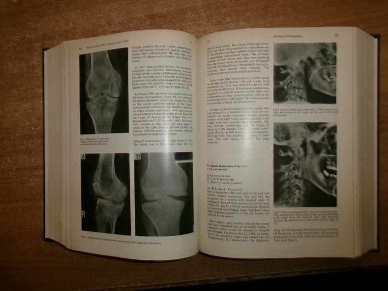 AA. VV. Proceedings of the ROYAL SOCIETY of MEDICINE 1969