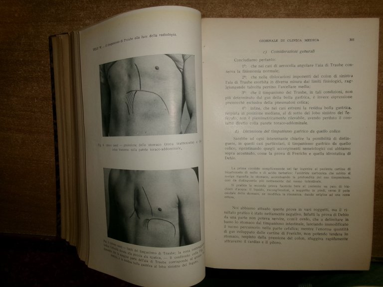 AA. VV. Prof. CAMPANACCI GIORNALE di CLINICA MEDICA 1951