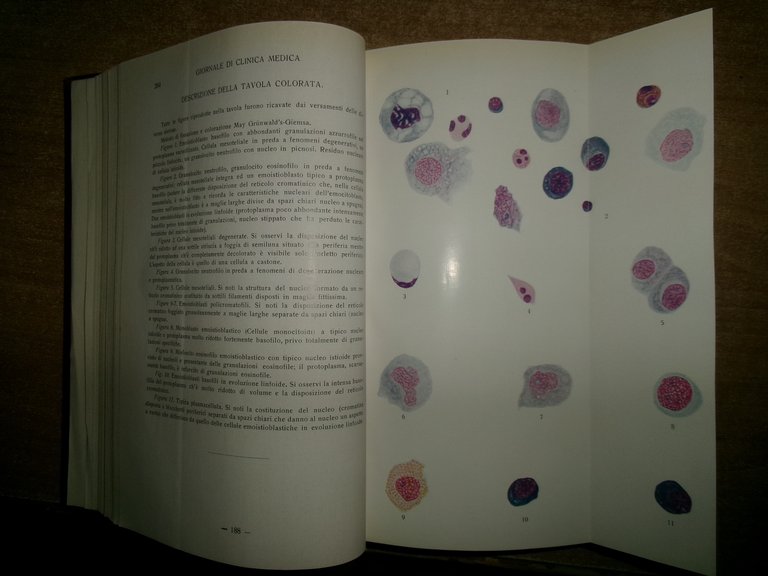 AA. VV. Sen. Prof. UMBERTO GABBI. Giornale di Clinica Medica. …