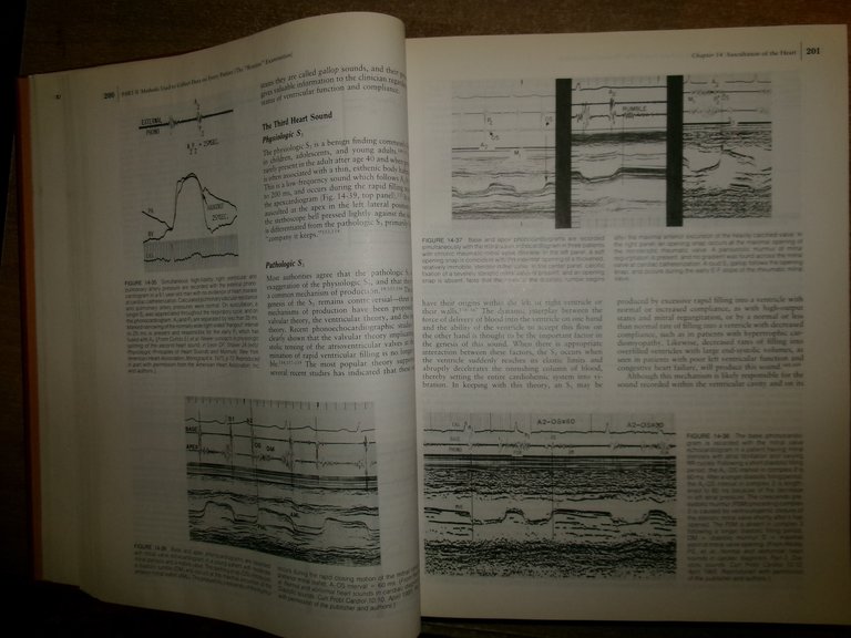 AA. VV. THE HEART Arteries and Veins. HURST/SCHLANT... 1990