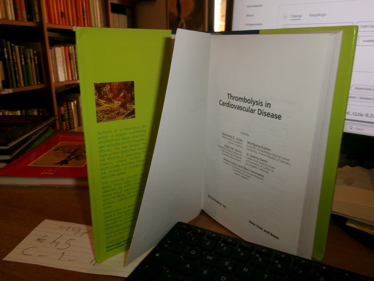 AA. VV. Thrombolysis in Cardiovascular Disease First Edition Edición 1989