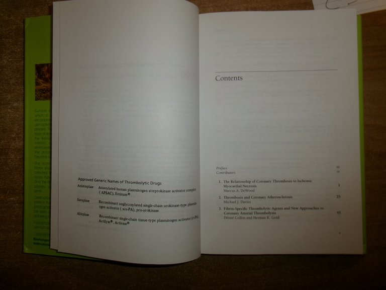 AA. VV. Thrombolysis in Cardiovascular Disease First Edition Edición 1989