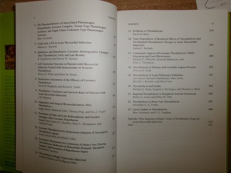 AA. VV. Thrombolysis in Cardiovascular Disease First Edition Edición 1989