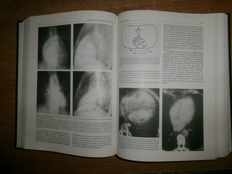 AA. VV. Trattato di cardiologia. Volumi 1-2-3, Excerpta medica, 2000