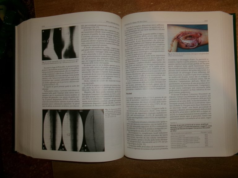 AA. VV. Trattato di cardiologia. Volumi 1-2-3, Excerpta medica, 2000