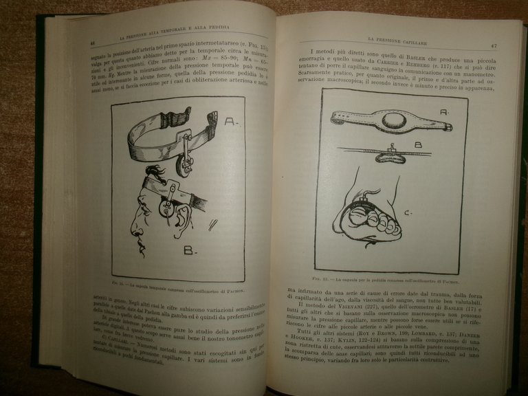 ALDO LUISADA. Ipotensione e Iposfigmia deficienze di circolo... 1929
