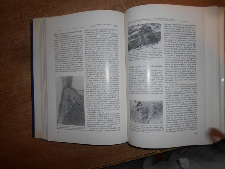 Autori Vari. CARDIOLOGIA 1987 21° Corso di Aggiornamento Centro A. …