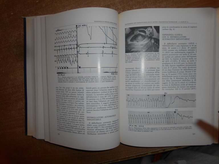 Autori Vari. CARDIOLOGIA 1987 21° Corso di Aggiornamento Centro A. …