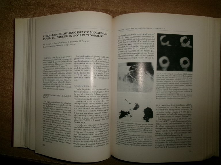 Autori Vari. CARDIOLOGIA 1990 Testi di aggiornamento e Atti del …