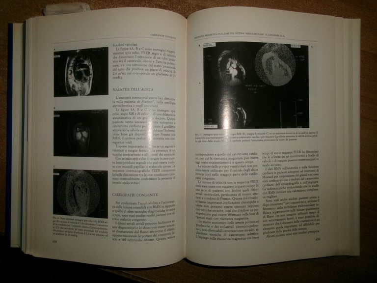 Autori Vari. CARDIOLOGIA 1990 Testi di aggiornamento e Atti del …