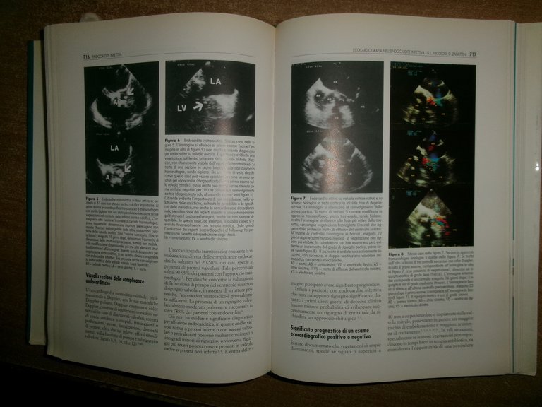 Autori Vari. CARDIOLOGIA 1993 Testi di aggiornamento e Atti del …