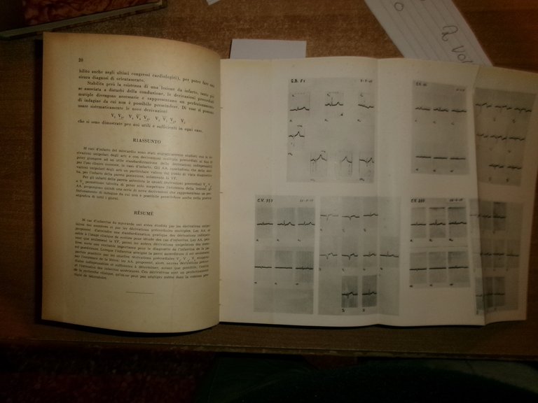 Autori Vari. FOLIA CARDIOLOGICA. Atti Soc. It. Card. 1940/1950
