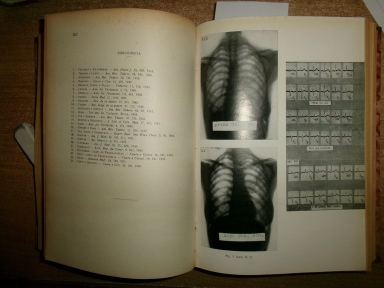 Autori Vari. FOLIA CARDIOLOGICA. Atti Soc. It. Card. 1940/1950