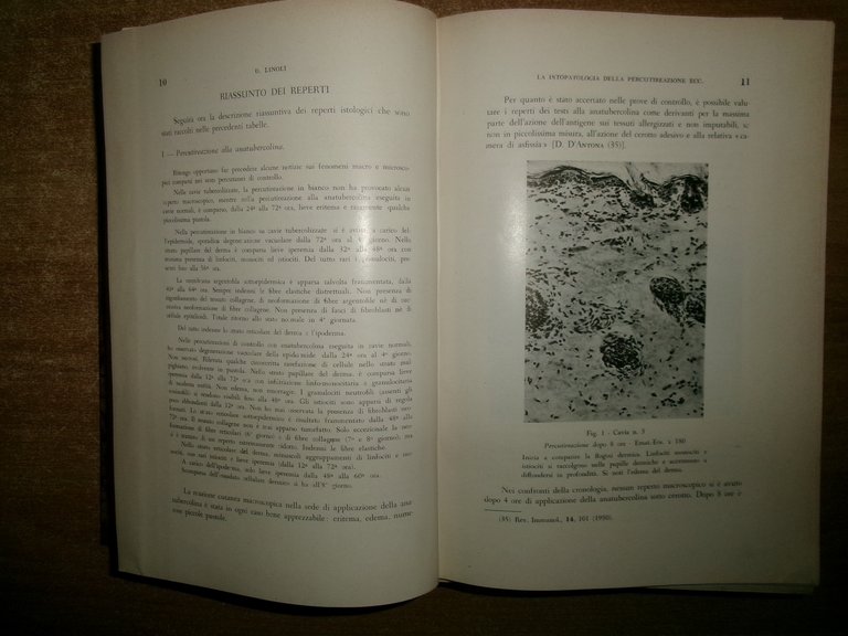 Autori Vari MISCELLANEA di numerosi estratti/opuscoli riguardanti la tubercolosi 1931