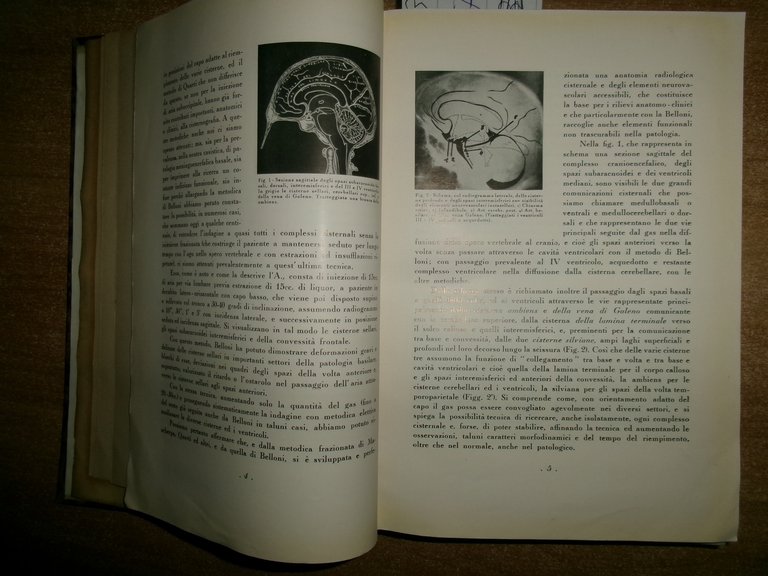 Autori Vari MISCELLANEA di numerosi opuscoli/estratti riguardanti la medicina...