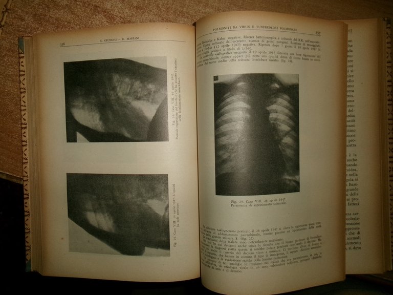 Autori Vari. RECENTI PROGRESSI in MEDICINA 1949 2 volumi