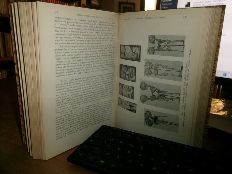 AUTORI VARI. RECENTI PROGRESSI in MEDICINA 1953. 2 volumi ex …