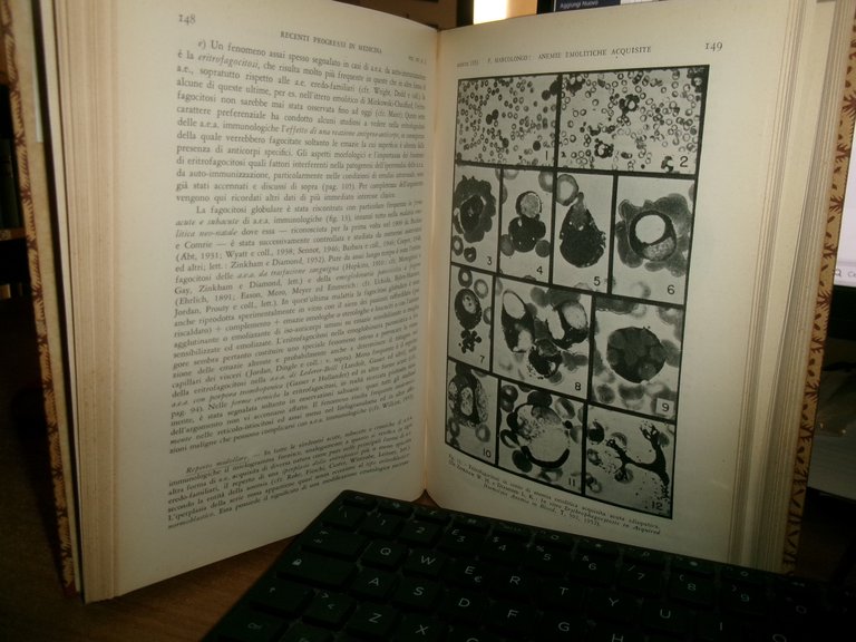 AUTORI VARI. RECENTI PROGRESSI in MEDICINA 1953. 2 volumi ex …