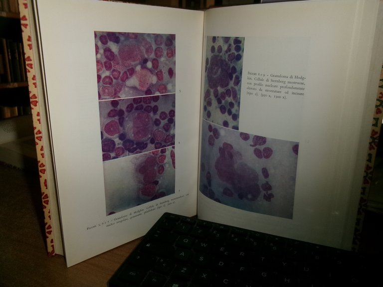 AUTORI VARI. RECENTI PROGRESSI in MEDICINA 1962 - 2 volumi: …