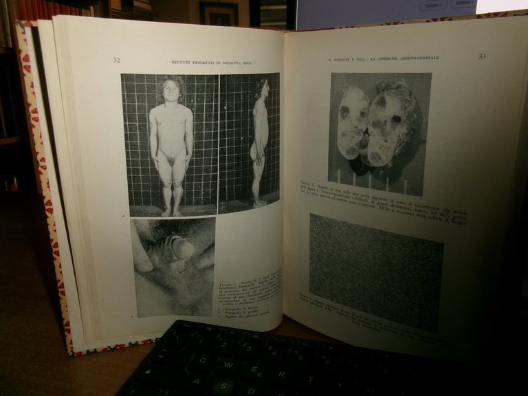 AUTORI VARI. RECENTI PROGRESSI in MEDICINA 1962 - 2 volumi: …