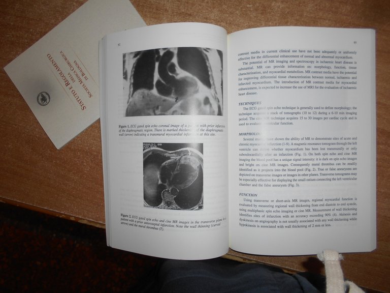 Cardiac Imaging: X-Ray, Mr, and Ultrasound. S. NITTER - HAUGE …