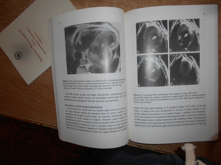 Cardiac Imaging: X-Ray, Mr, and Ultrasound. S. NITTER - HAUGE …