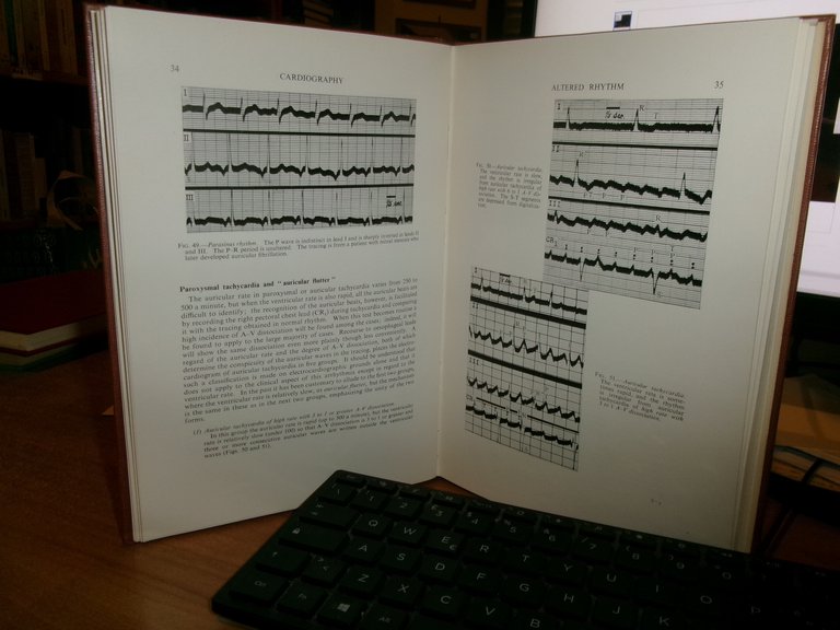 CARDIOGRAPHY Second Edition. By WILLIAM EVANS 1954