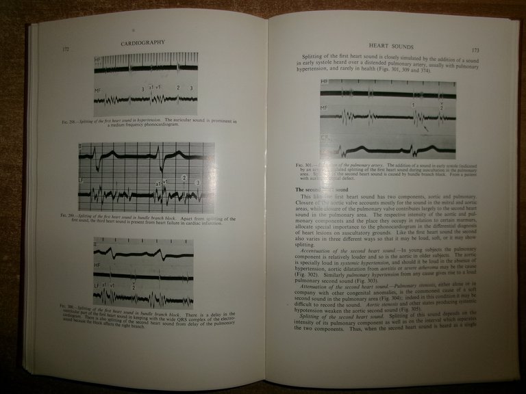 CARDIOGRAPHY Second Edition. By WILLIAM EVANS 1954